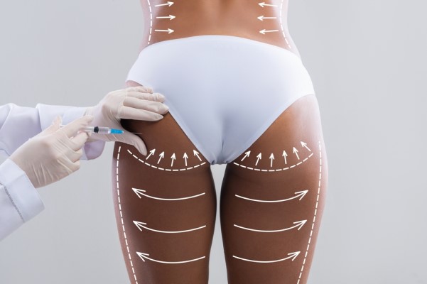 What To Expect Before Getting a Brazilian Butt Lift - Paul C. Dillon, MD  Inc Schaumburg, IL 60173