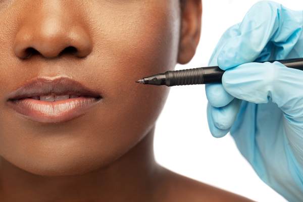 FAQs About Cosmetic Surgery