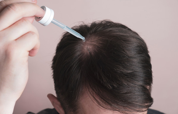 Hair Growth Treatment Options From A Hair Clinic