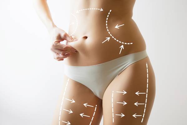 What Are the Benefits of a Tummy Tuck? - Paul C. Dillon, MD Inc Schaumburg,  IL 60173